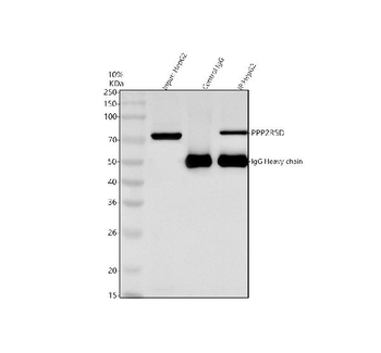 Anti-PPP2R5D Antibody