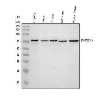 Anti-PPP2R5D Antibody