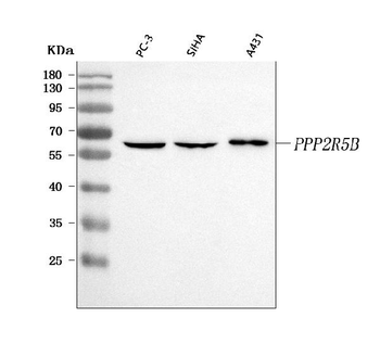 Anti-PPP2R5B Antibody
