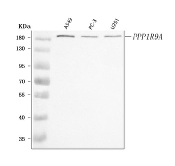 PPP1R9A Antibody