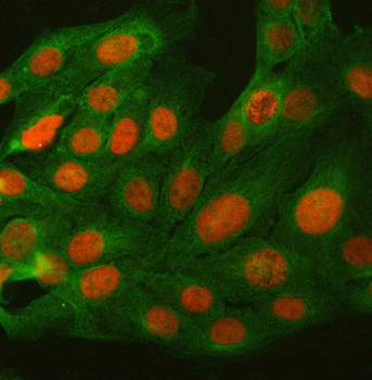 Anti-BCL11B Antibody