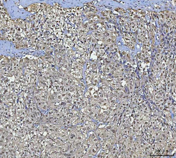 Anti-BCL11B Antibody