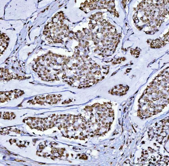 Anti-BCL11B Antibody