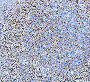 Anti-BCL11B Antibody