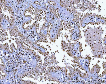 Anti-BCL11B Antibody