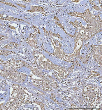 Anti-BCL11B Antibody