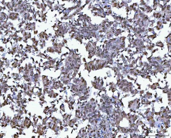 Anti-BCL11B Antibody