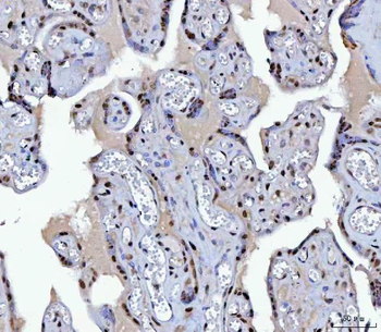 Anti-BCL11B Antibody