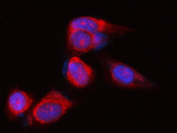 Anti-POLR1B Antibody