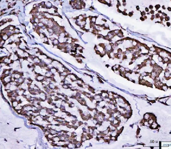 Anti-POLR1B Antibody