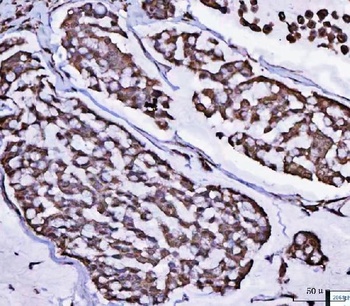 POLR1B Antibody