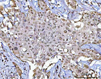 Anti-POLR1B Antibody
