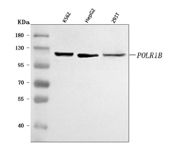 Anti-POLR1B Antibody