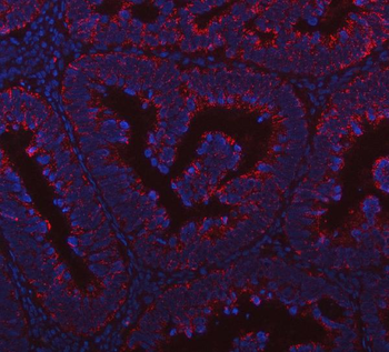 Anti-PRDM15 Antibody