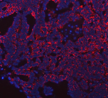 Anti-PRDM15 Antibody