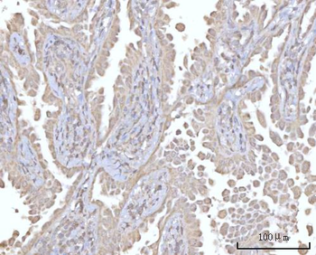 Anti-PRDM15 Antibody