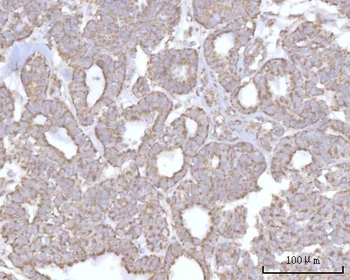 Anti-PRDM15 Antibody