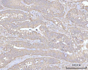 Anti-PRDM15 Antibody
