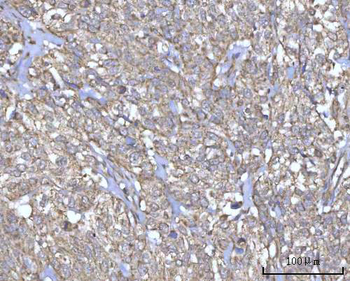 Anti-PRDM15 Antibody