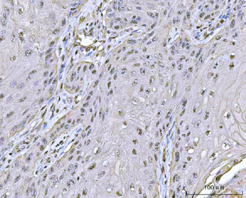 Anti-PPM1G Antibody