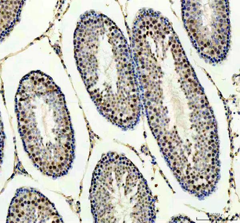 Anti-PPM1G Antibody