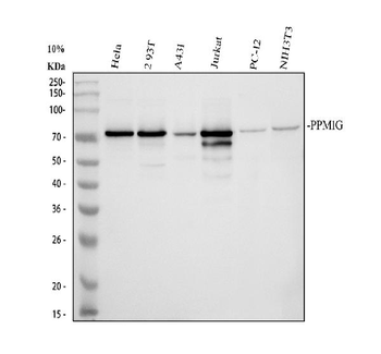 Anti-PPM1G Antibody