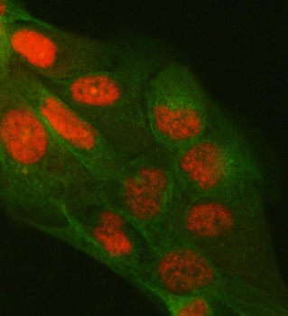 Anti-PPM1G Antibody