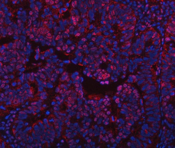 Anti-PPM1G Antibody