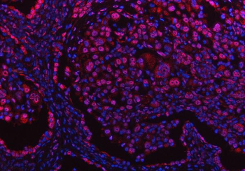Anti-PPM1G Antibody
