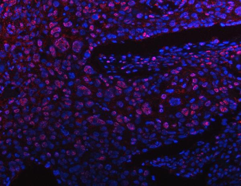 Anti-PPM1G Antibody