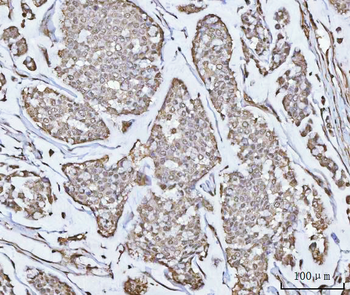 Anti-PPM1G Antibody