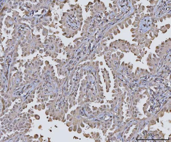 Anti-PPM1G Antibody