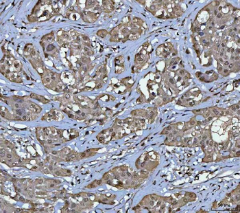 Anti-PPM1G Antibody
