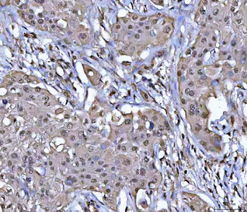 Anti-PPM1G Antibody