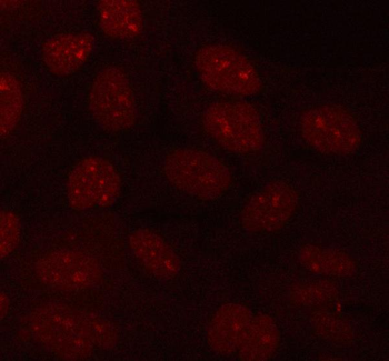 Anti-PLEKHA1 Antibody