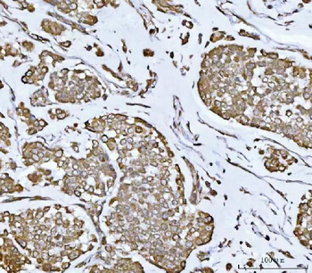 Anti-PLEKHA1 Antibody