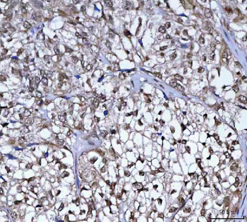 Anti-PLEKHA1 Antibody
