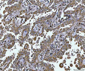 Anti-PLEKHA1 Antibody