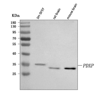 Anti-PDXP Antibody