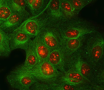 Anti-POLR2H Antibody
