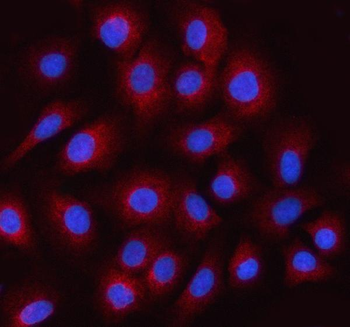 Anti-STRADB Antibody