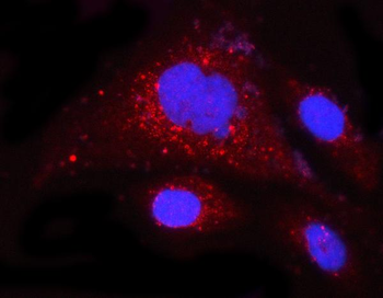 Anti-MCL1 Antibody
