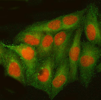 Anti-ATF4 Antibody