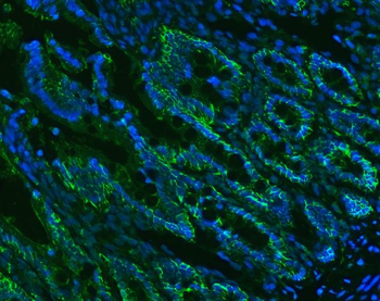 Anti-CD326/Epcam Antibody