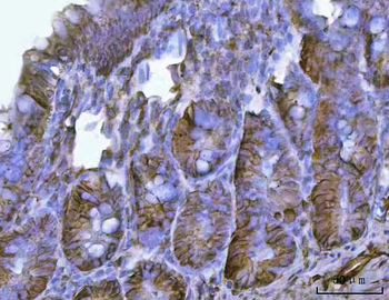 Anti-CD326/Epcam Antibody