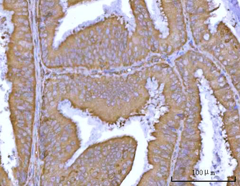 Anti-DR5/TNFRSF10B Antibody