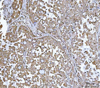Anti-DR5/TNFRSF10B Antibody