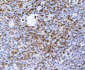 Anti-DR5/TNFRSF10B Antibody