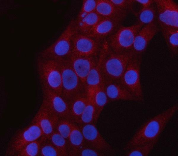Anti-PNPLA6 Antibody