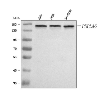 Anti-PNPLA6 Antibody